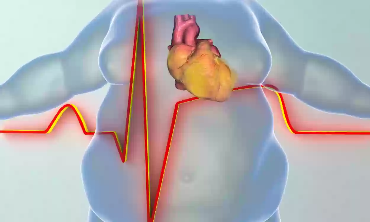 عقار لإنقاص الوزن يلعب دور مذهل في علاج أمراض القلب